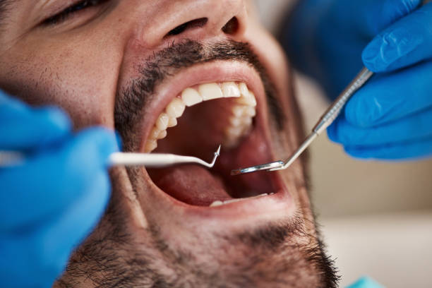 Best Full Mouth Reconstruction  in Dollar Bay, MI